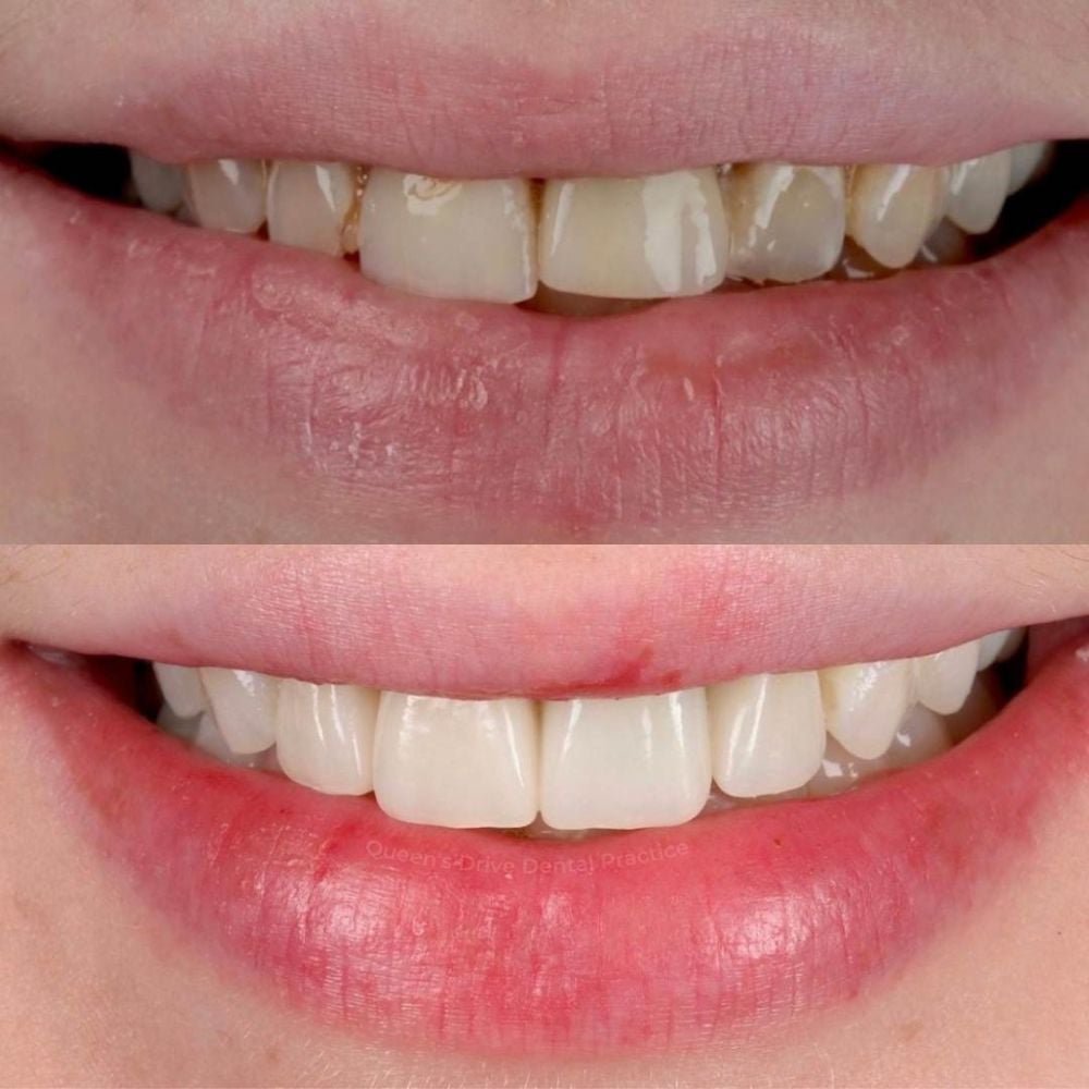 Queens Drive Dental Practice | Smile Gallery Queens Drive Dental Practice | Smile Gallery