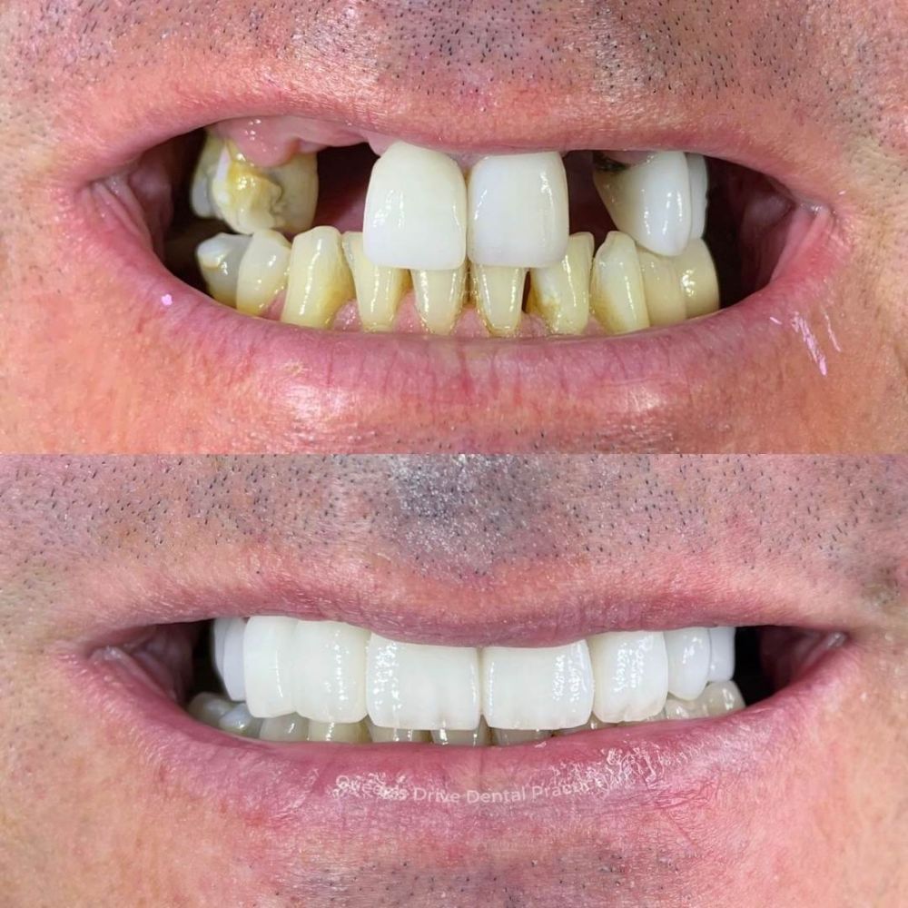 Queens Drive Dental Practice | Smile Gallery Queens Drive Dental Practice | Smile Gallery