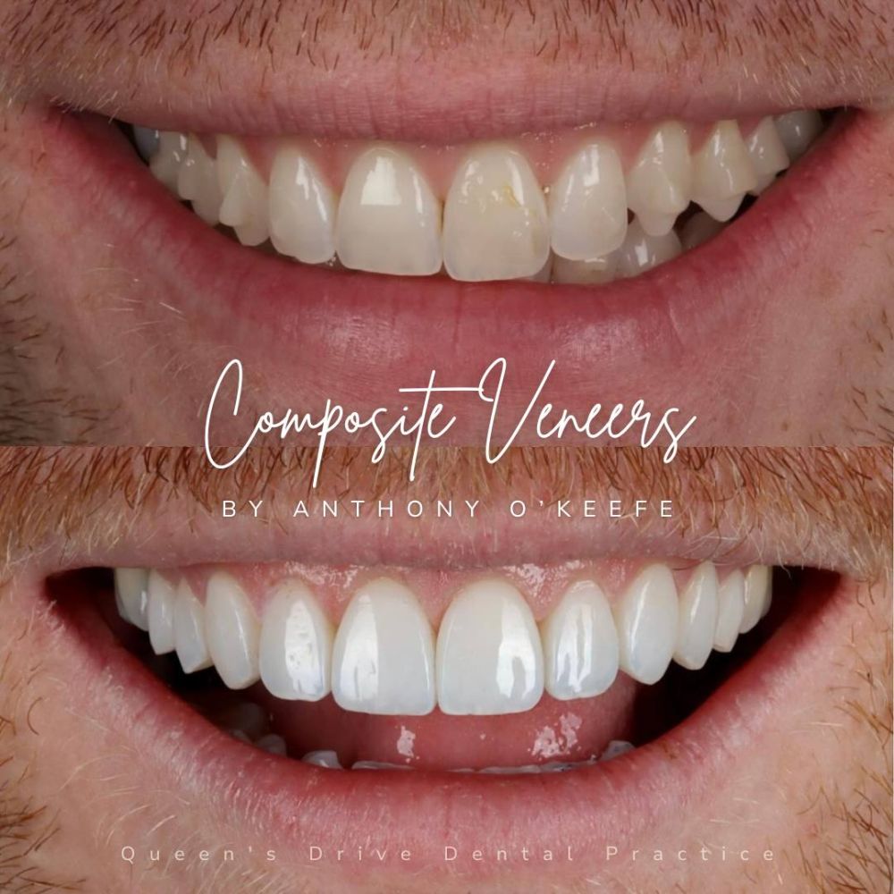 Queens Drive Dental Practice | Smile Gallery Queens Drive Dental Practice | Smile Gallery
