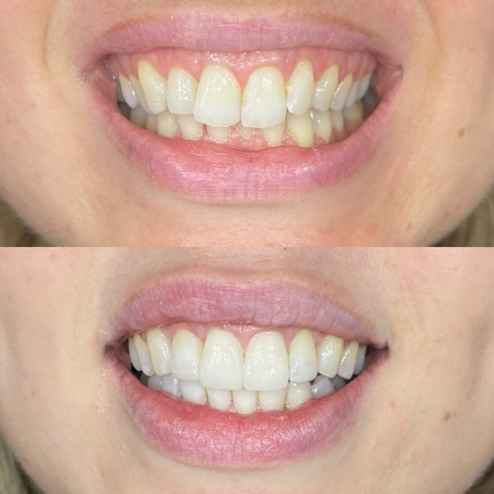 Queens Drive Dental Practice | Smile Gallery Queens Drive Dental Practice | Smile Gallery