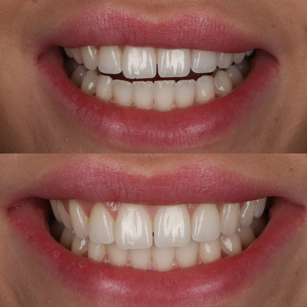Queens Drive Dental Practice | Smile Gallery Queens Drive Dental Practice | Smile Gallery