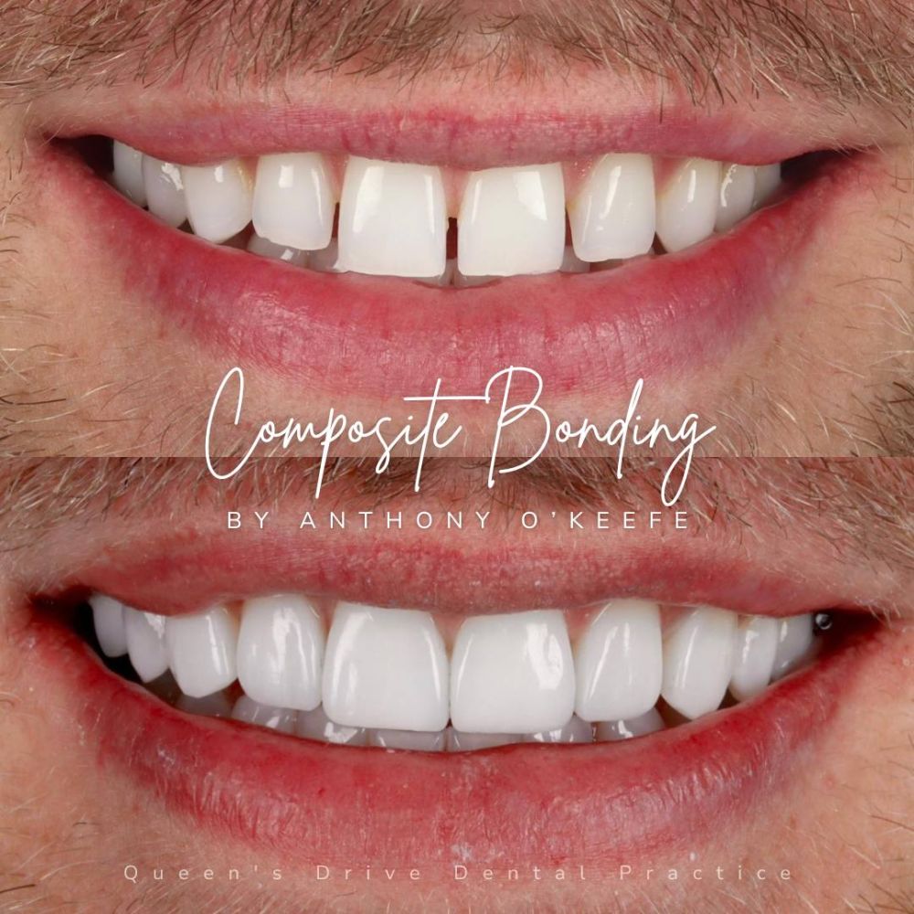 Queens Drive Dental Practice | Smile Gallery Queens Drive Dental Practice | Smile Gallery
