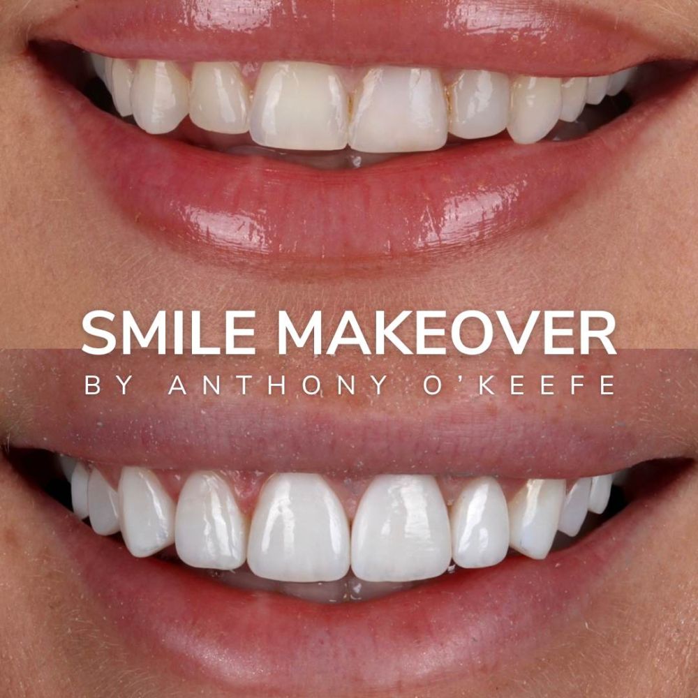 Queens Drive Dental Practice | Smile Gallery Queens Drive Dental Practice | Smile Gallery