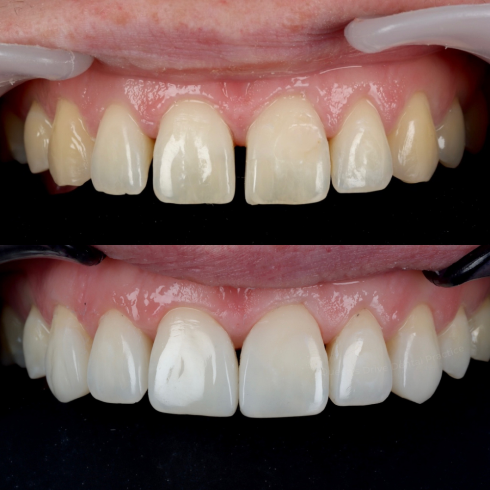 Queens Drive Dental Practice | Smile Gallery Queens Drive Dental Practice | Smile Gallery