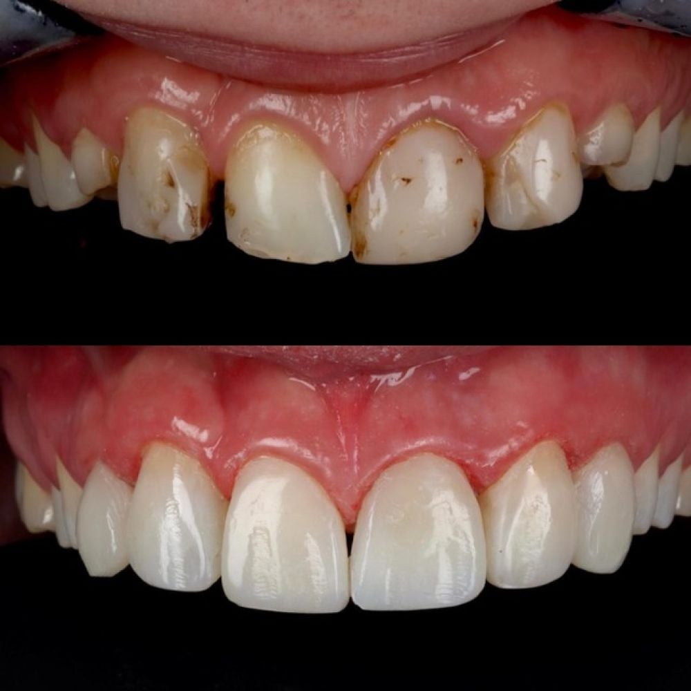 Queens Drive Dental Practice | Smile Gallery Queens Drive Dental Practice | Smile Gallery