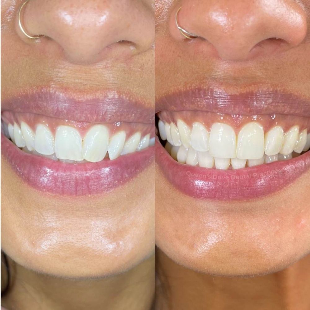 Queens Drive Dental Practice | Smile Gallery Queens Drive Dental Practice | Smile Gallery