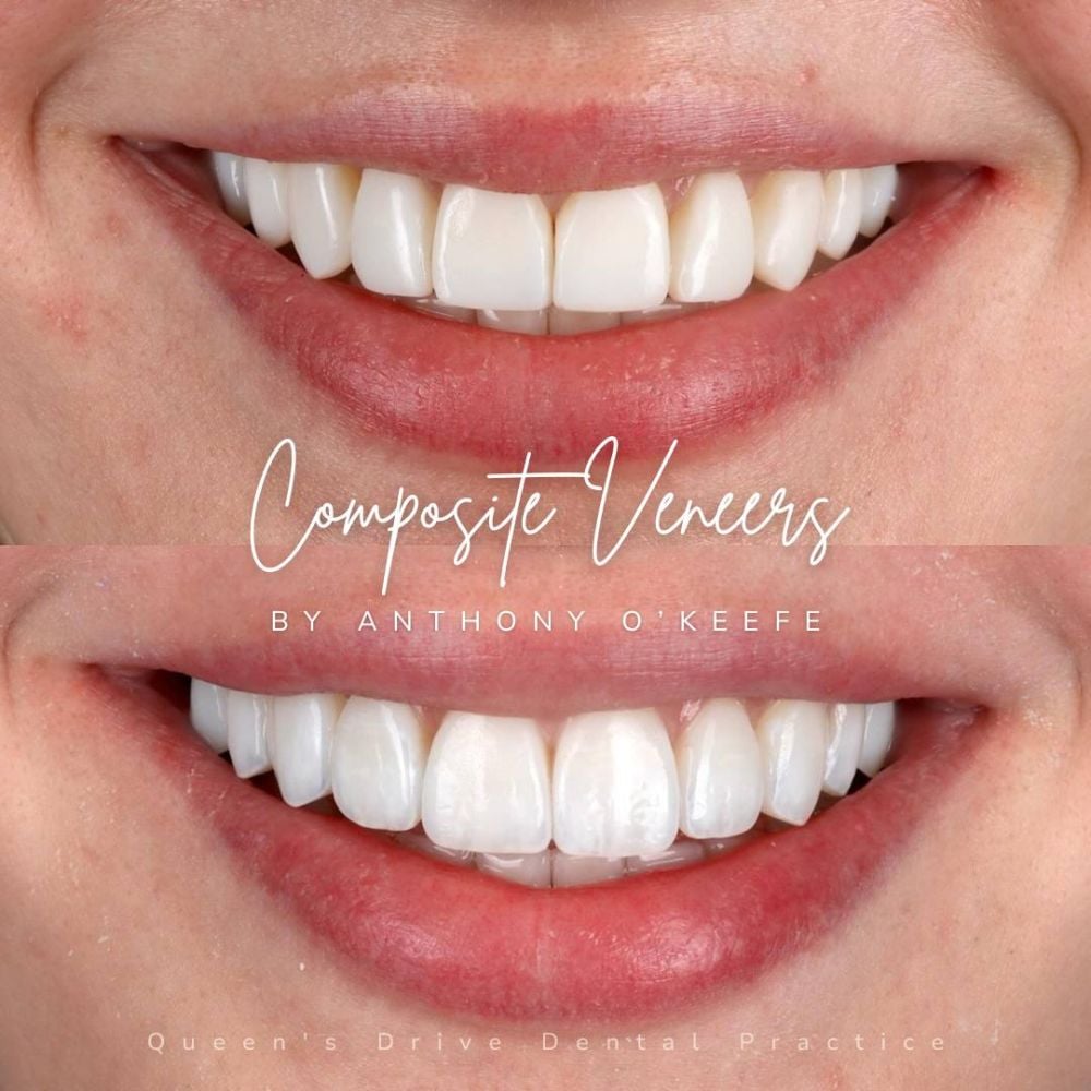 Queens Drive Dental Practice | Smile Gallery Queens Drive Dental Practice | Smile Gallery