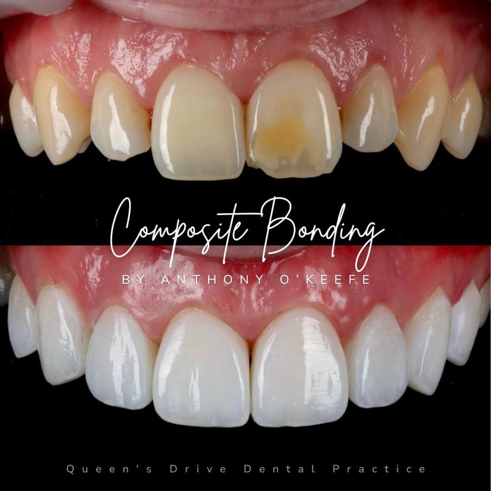 Queens Drive Dental Practice | Smile Gallery Queens Drive Dental Practice | Smile Gallery