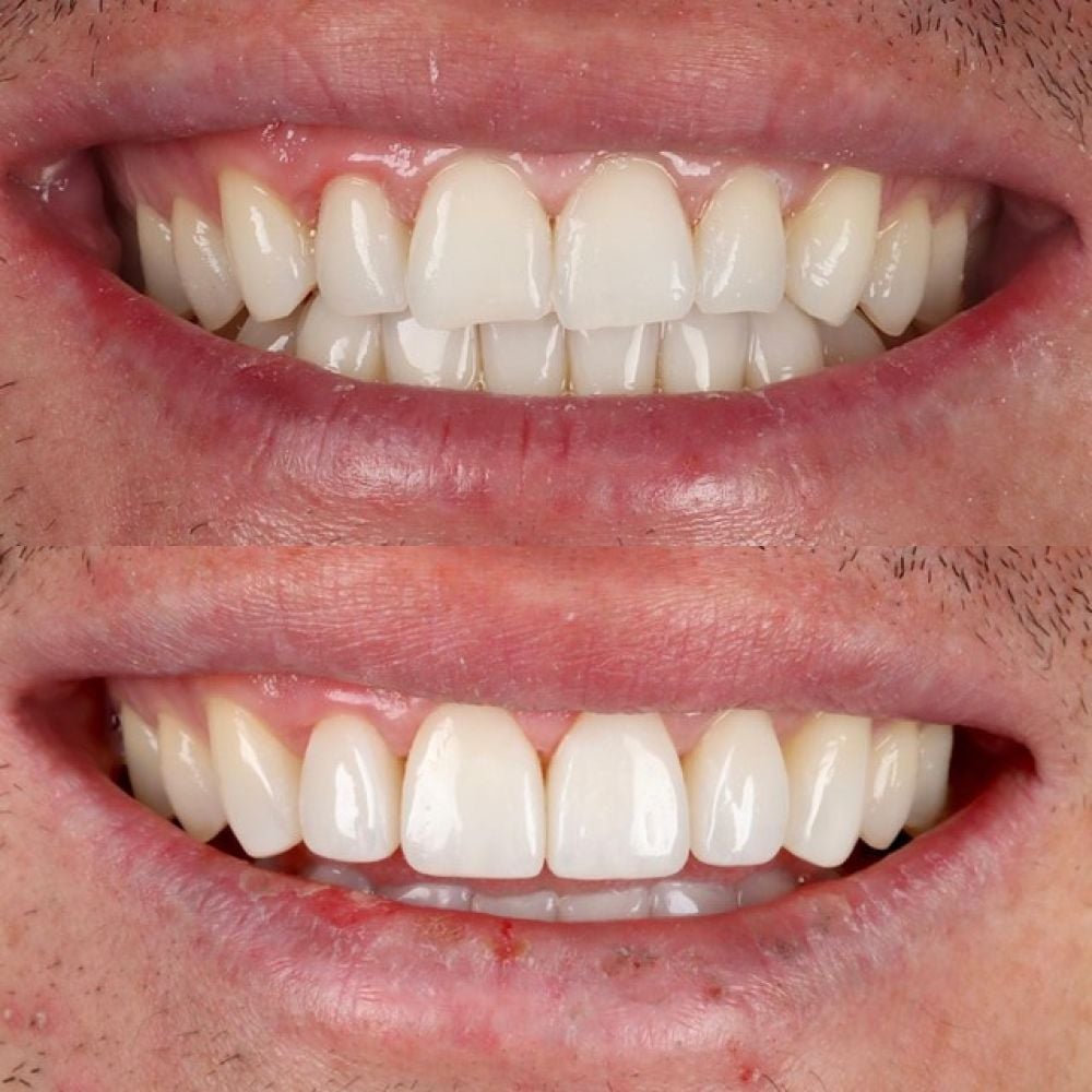 Queens Drive Dental Practice | Smile Gallery Queens Drive Dental Practice | Smile Gallery