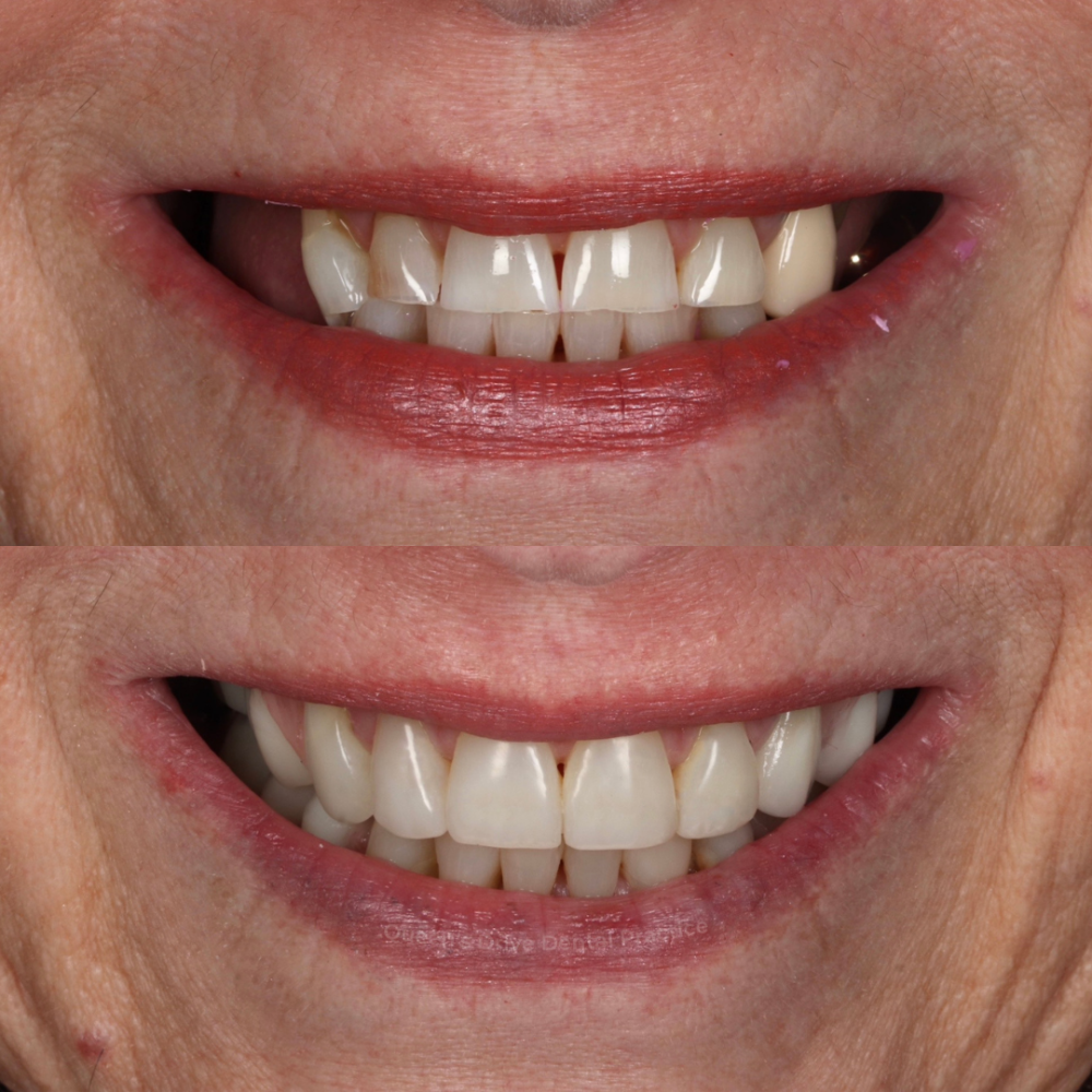 Queens Drive Dental Practice | Smile Gallery Queens Drive Dental Practice | Smile Gallery
