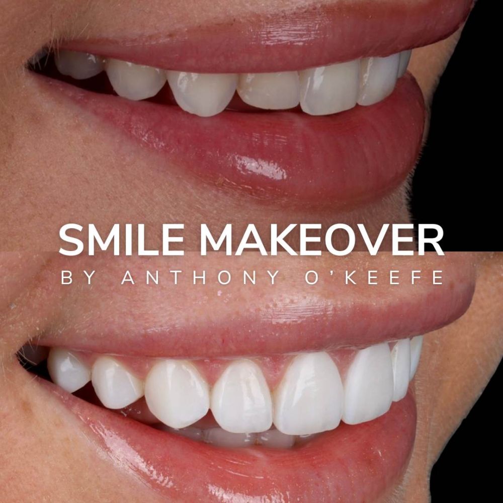 Queens Drive Dental Practice | Smile Gallery Queens Drive Dental Practice | Smile Gallery