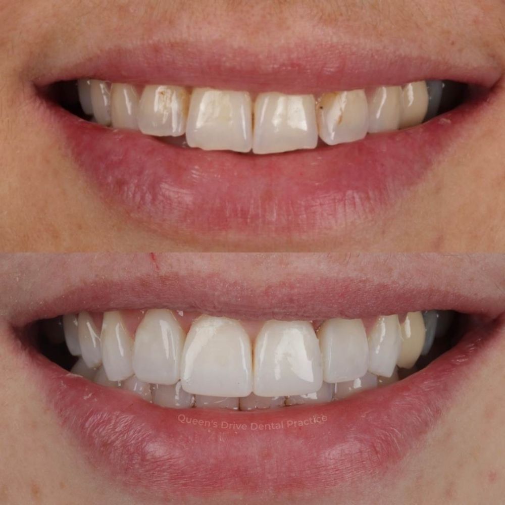 Queens Drive Dental Practice | Smile Gallery Queens Drive Dental Practice | Smile Gallery