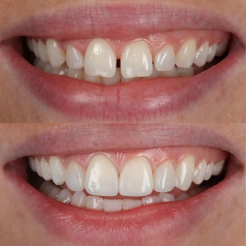 Queens Drive Dental Practice | Smile Gallery Queens Drive Dental Practice | Smile Gallery