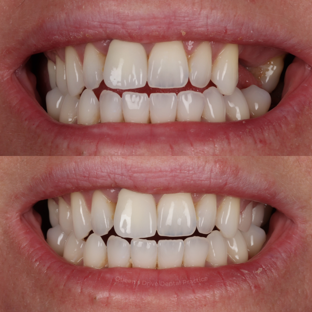 Queens Drive Dental Practice | Smile Gallery Queens Drive Dental Practice | Smile Gallery