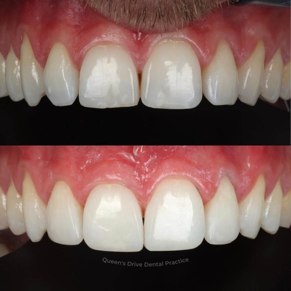 Queens Drive Dental Practice | Smile Gallery Queens Drive Dental Practice | Smile Gallery