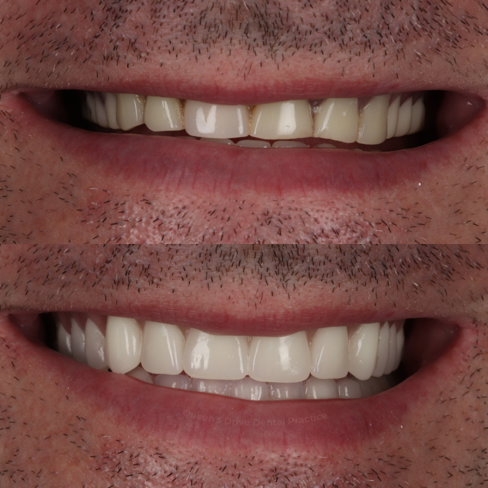 Queens Drive Dental Practice | Smile Gallery Queens Drive Dental Practice | Smile Gallery