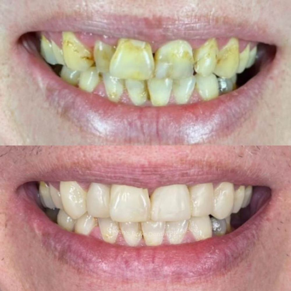 Queens Drive Dental Practice | Smile Gallery Queens Drive Dental Practice | Smile Gallery