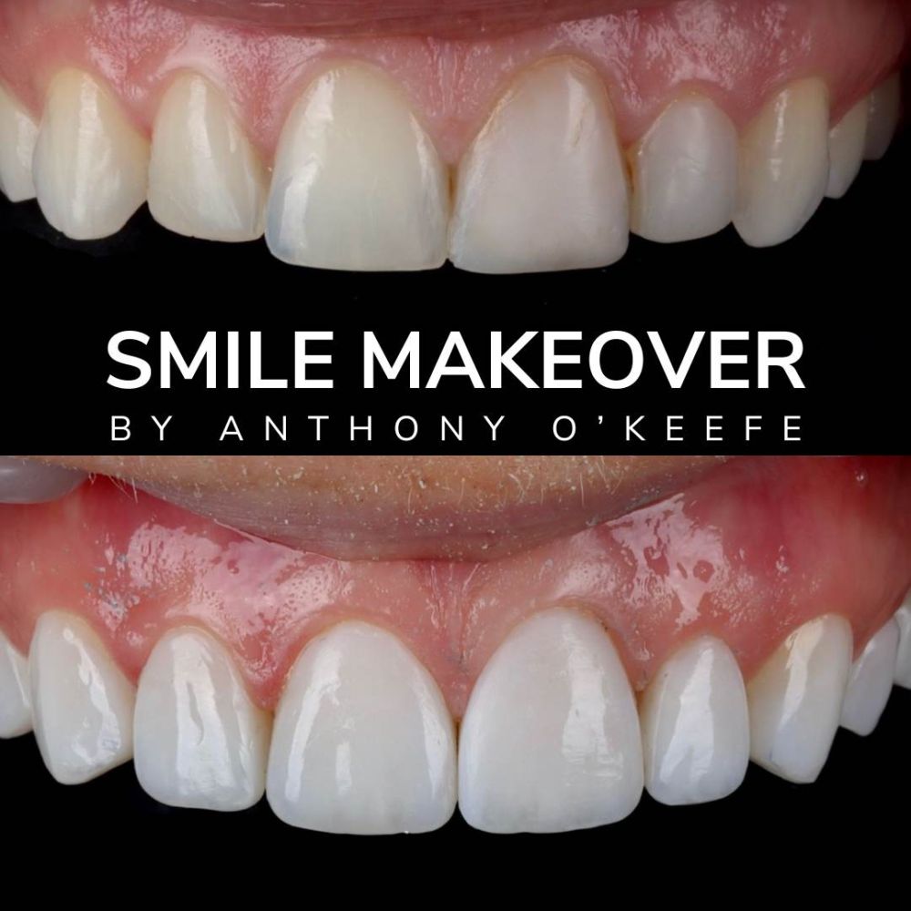 Queens Drive Dental Practice | Smile Gallery Queens Drive Dental Practice | Smile Gallery