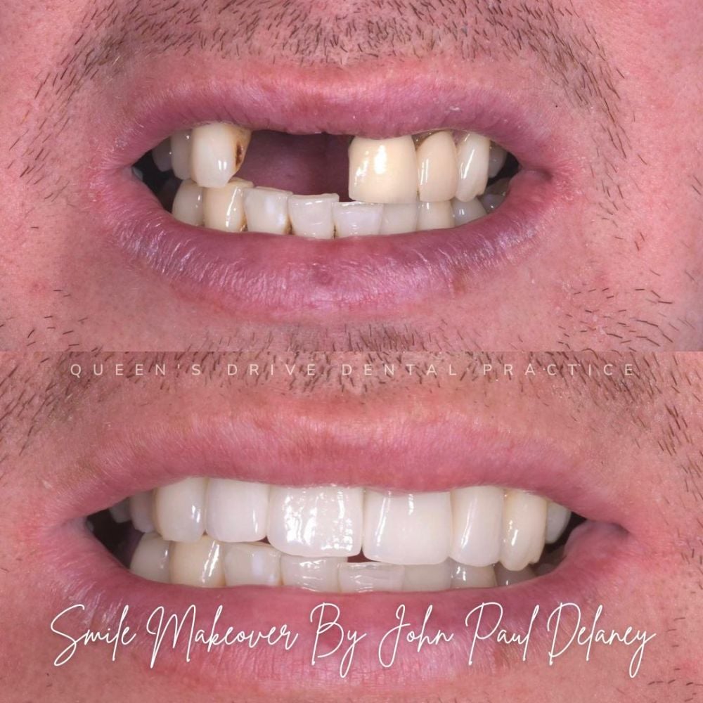 Queens Drive Dental Practice | Smile Gallery Queens Drive Dental Practice | Smile Gallery